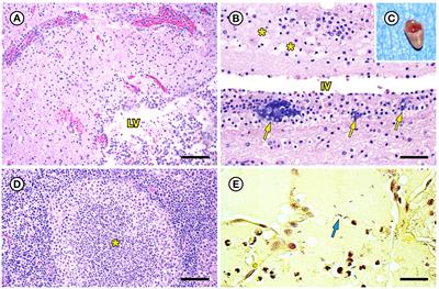 Pathology, microbiology, and genetic diversity associated with Erysipelothrix rhusiopathiae and novel Erysipelothrix spp. infections in southern sea otters (Enhydra lutris nereis)